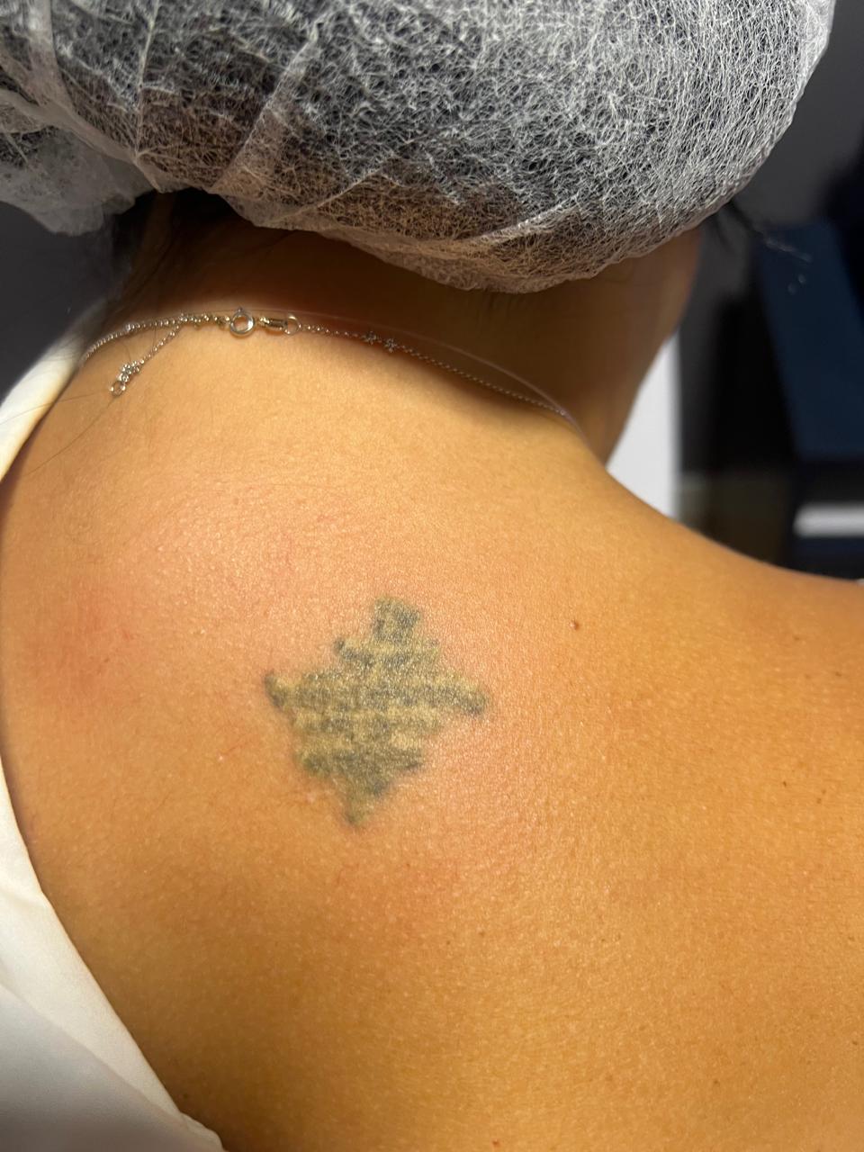 Depois do tratamento — caso 2